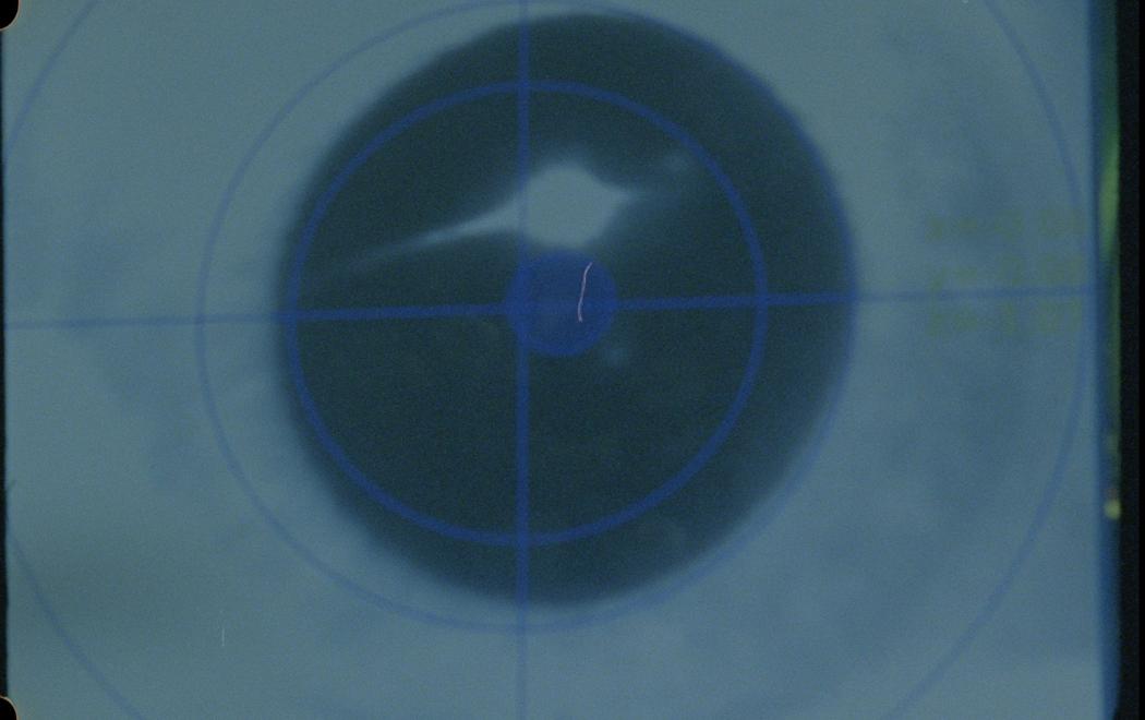 A blue-hued screen with an enlarged iris overlaid with a target diagram